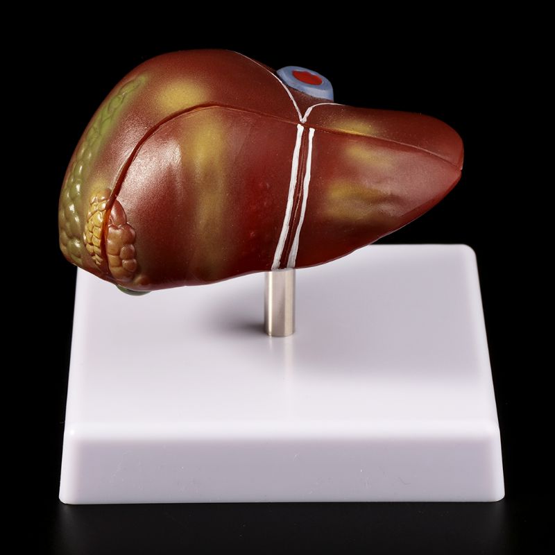 Fegato umano Patologico Modell - Medical Lab Assistant recensione e prezzo