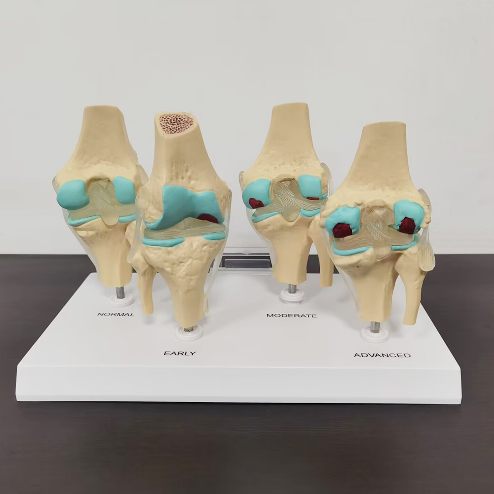 Modello di articolazione del g - Medical Lab Assistant recensione e prezzo